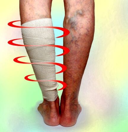 Terapia kompresyjna