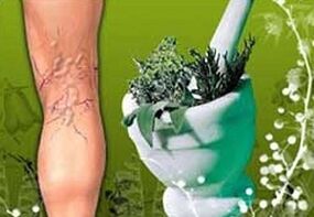 zioła stosowane w leczeniu żylaków