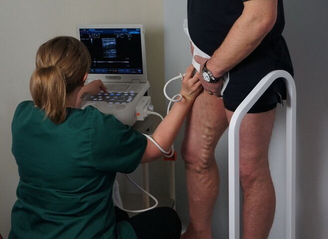 badanie żył przed koagulacją laserową pod kątem żylaków